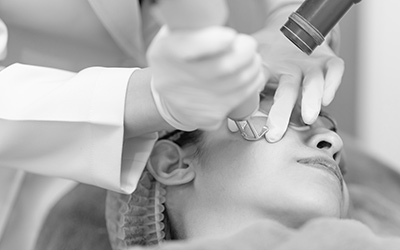 Laser Treatments