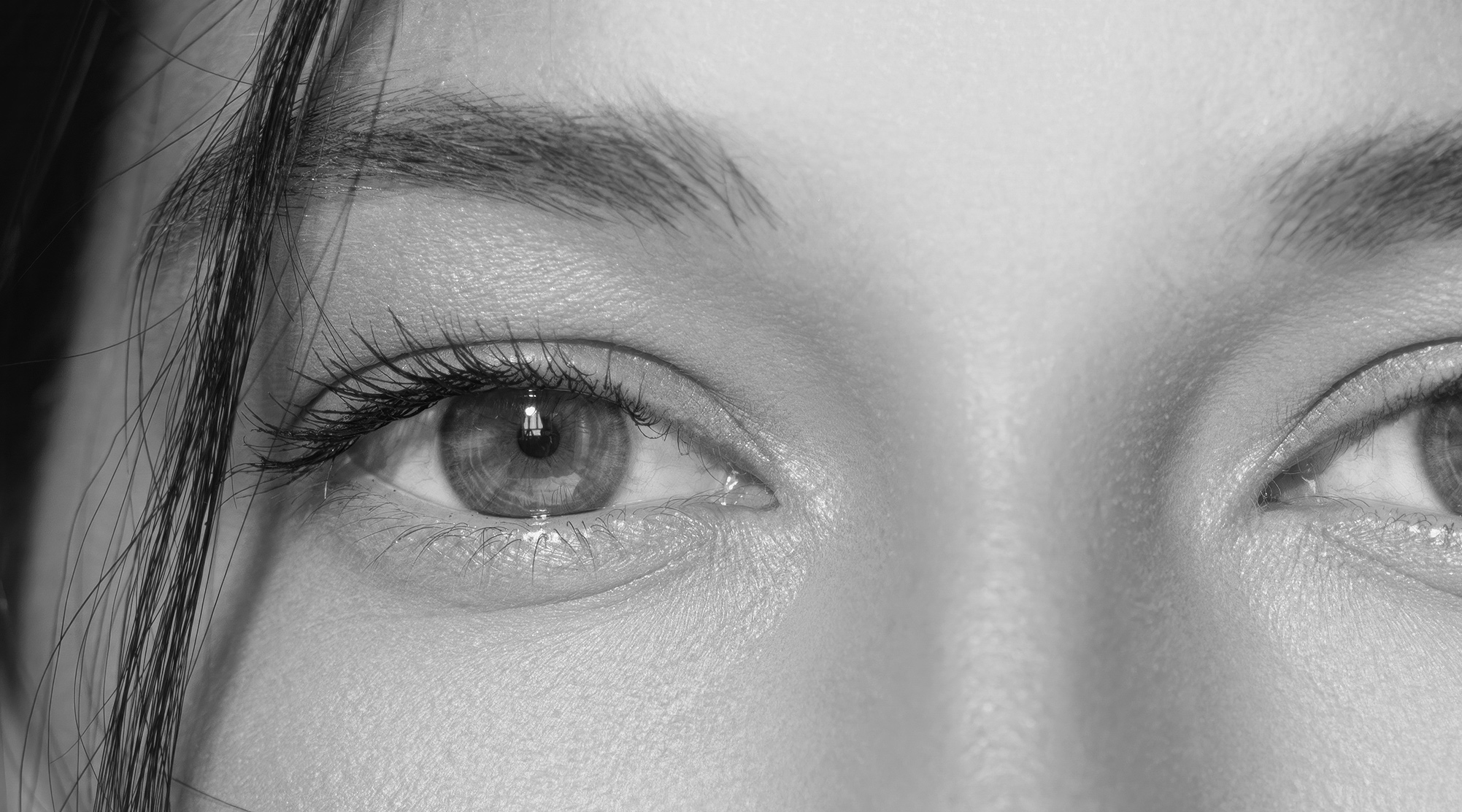 Tear Trough Rejuvenation